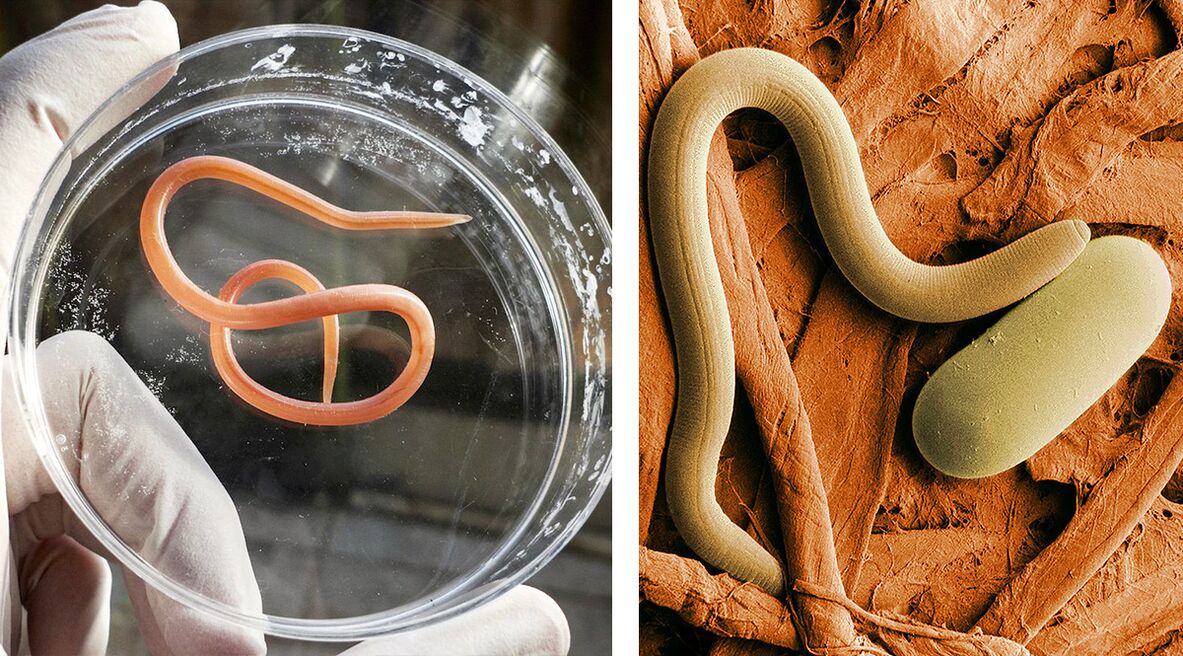 parazitai žmogaus organizme