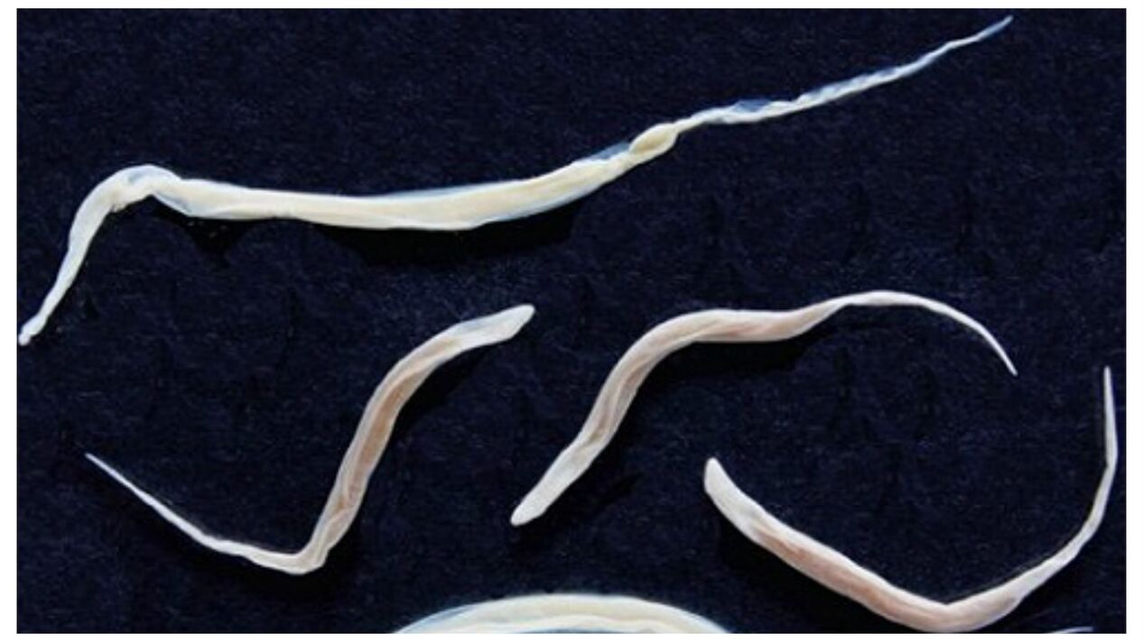 Pinworms yra paplitę parazitai, priklausantys helmintų grupei.